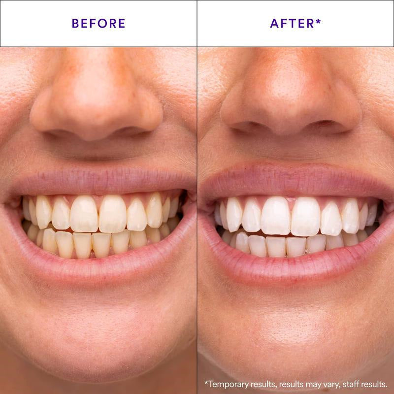 Solencia whitening strips